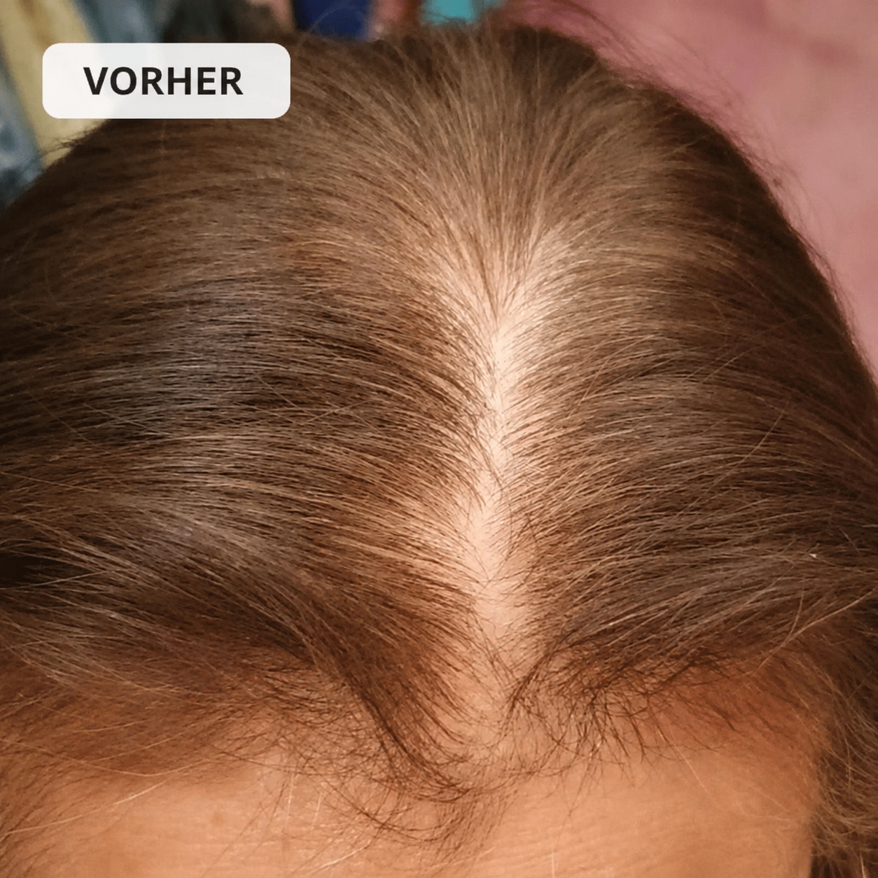 LUMERA Premier Cap™