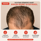 LUMERA Premier Cap™